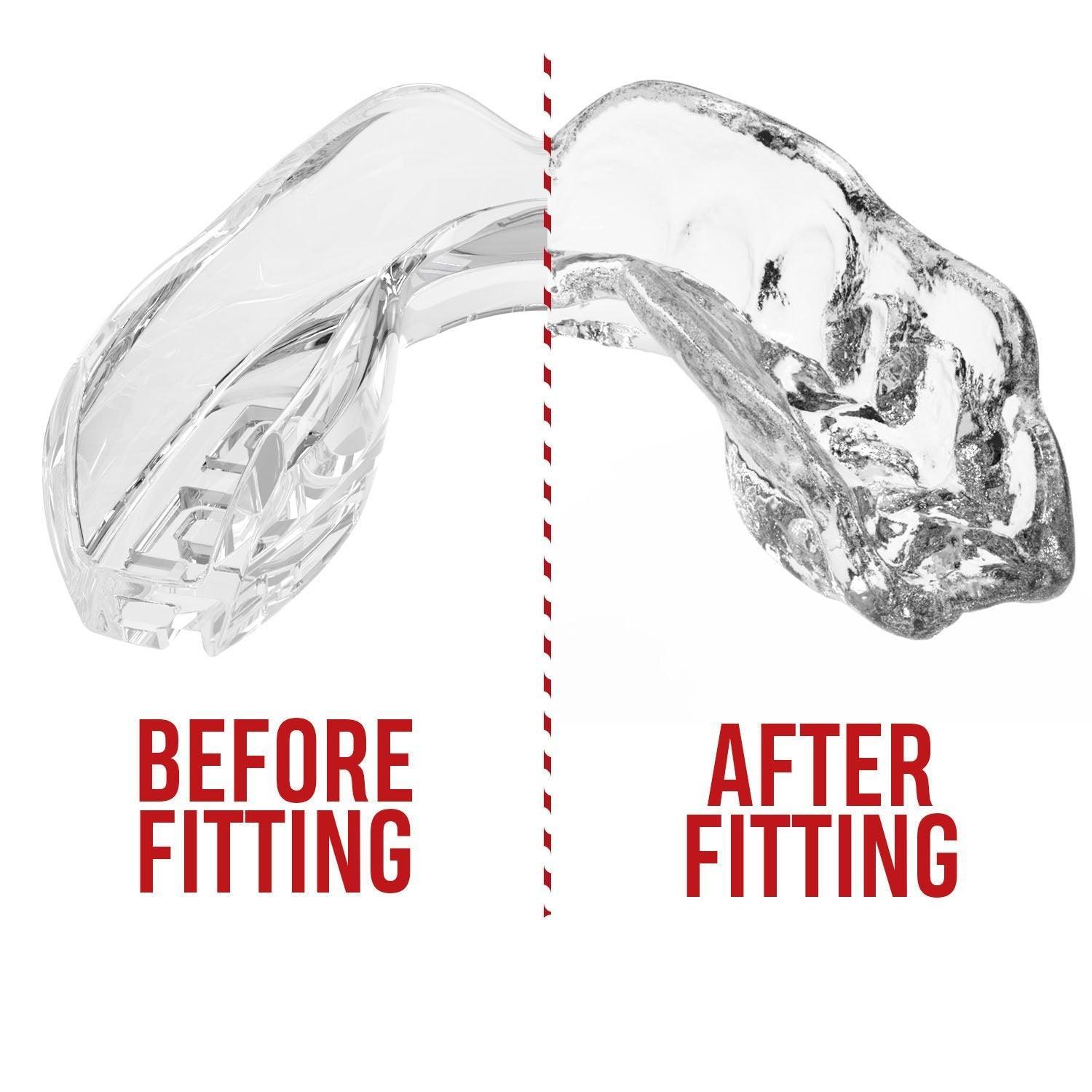 SAFEJAWZ Intro Series Mouthguard - Clear - Muay Thailand