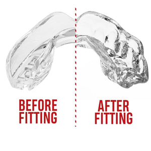 SAFEJAWZ Intro Series Mouthguard - Clear - Muay Thailand