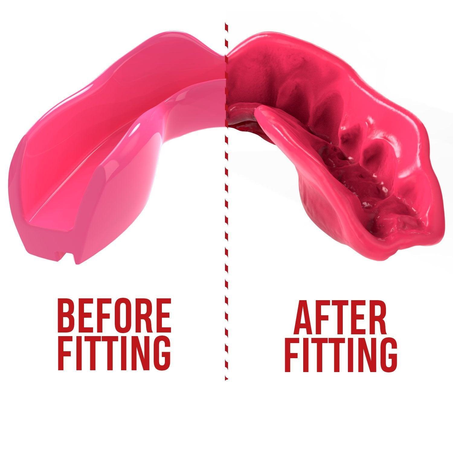 SAFEJAWZ Intro Series Mouthguard - Pink - Muay Thailand