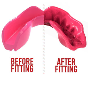 SAFEJAWZ Intro Series Mouthguard - Pink - Muay Thailand